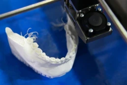 impresión dental 3d