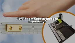 Férulas a Medida Hechas con Impresión 3D
