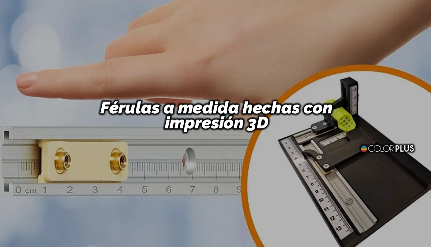 Férulas a Medida Hechas con Impresión 3D